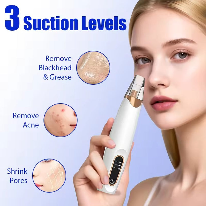Electric Blackhead Remover Vacuum