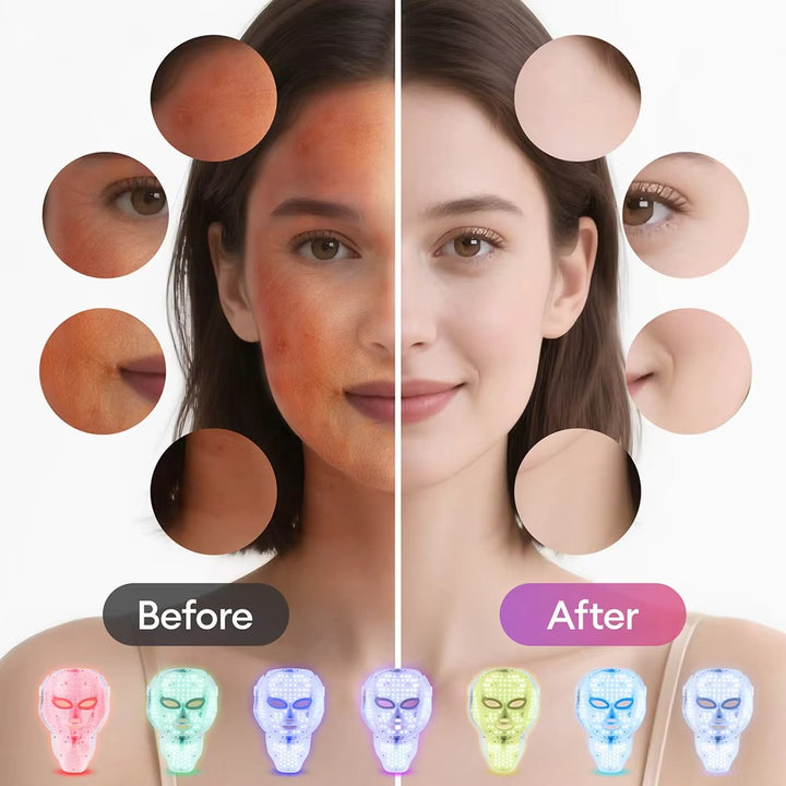 LED Face Mask – Anti-Aging Skin Tightening Light Therapy