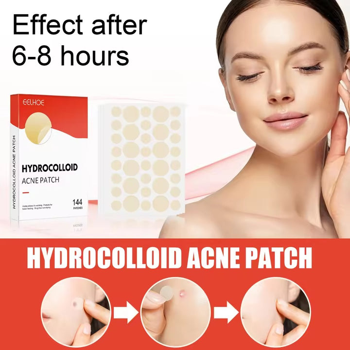 Pimple & Acne Patches